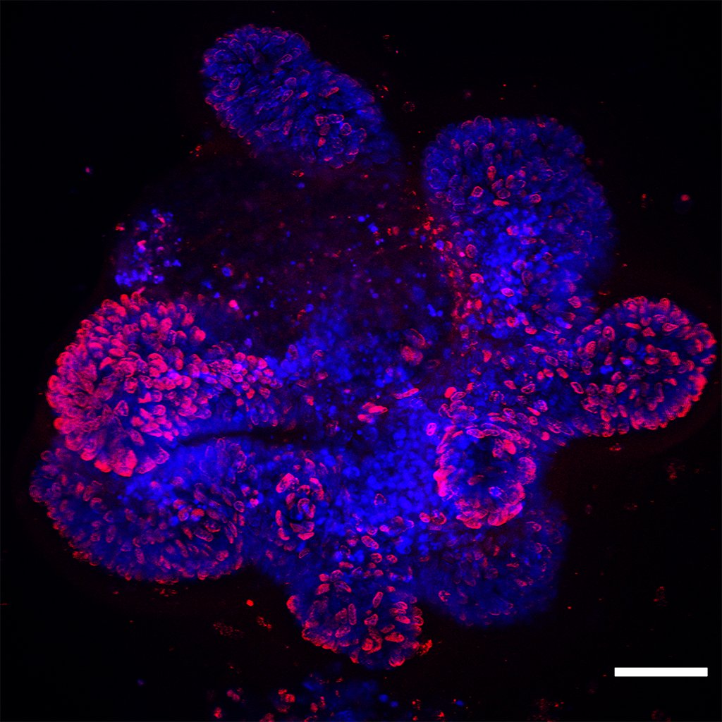 Organoids-brdu-dapi-6sept19-ctr